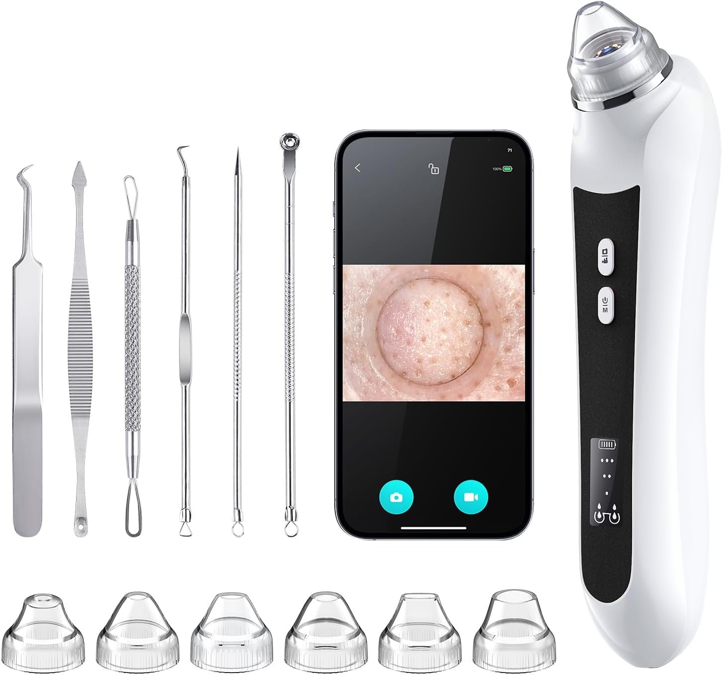 Blackhead Remover Vacuum, USB Interface Type Pore Vacuum, Black Head Extractions Tool with Camera for Men and Women Pore Cleaner, 3 Adjustment Modes & 6 Suction Heads(Black)